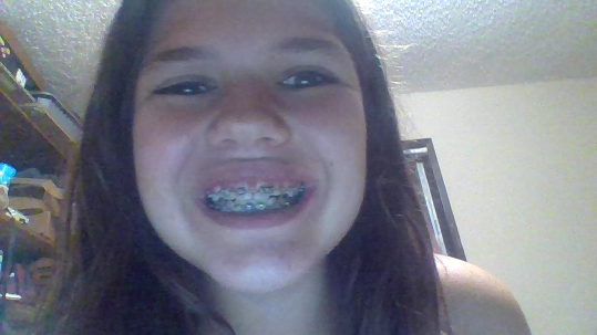I got braces by Cole-N-Sav